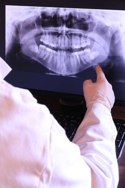 Best Root Canal Emergency Dentist  in Woodson Terrace, MO